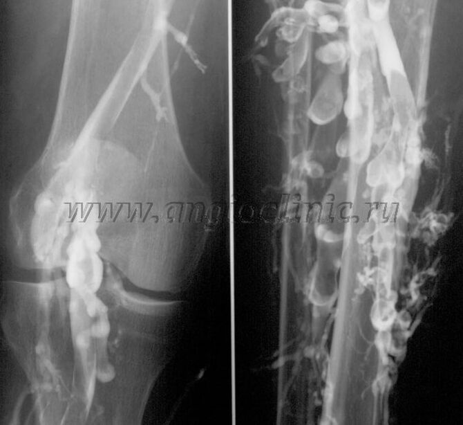 Ultratovush tekshiruvi